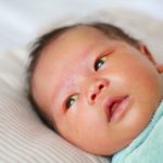 Желтуха у новорожденных — Симптомы, причины и лечение