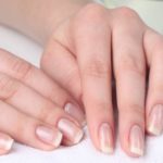 Причины ломкости и расслоение ногтей и способы их лечения